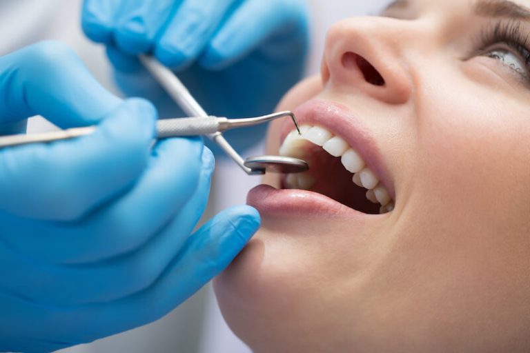 Why Getting A Crown May Be Better Than A Filling Silver Smile Dental